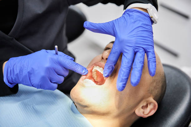 Best Dentist for Severe Toothache  in Bellevue, OH